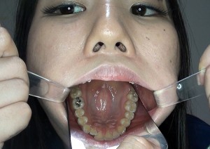 MP4-FMS-00002_sample_05[1]